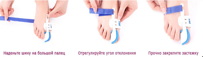 Инструкция по использованию фиксатора Hav Splint Инструкция по использованию фиксатора Hav Splint