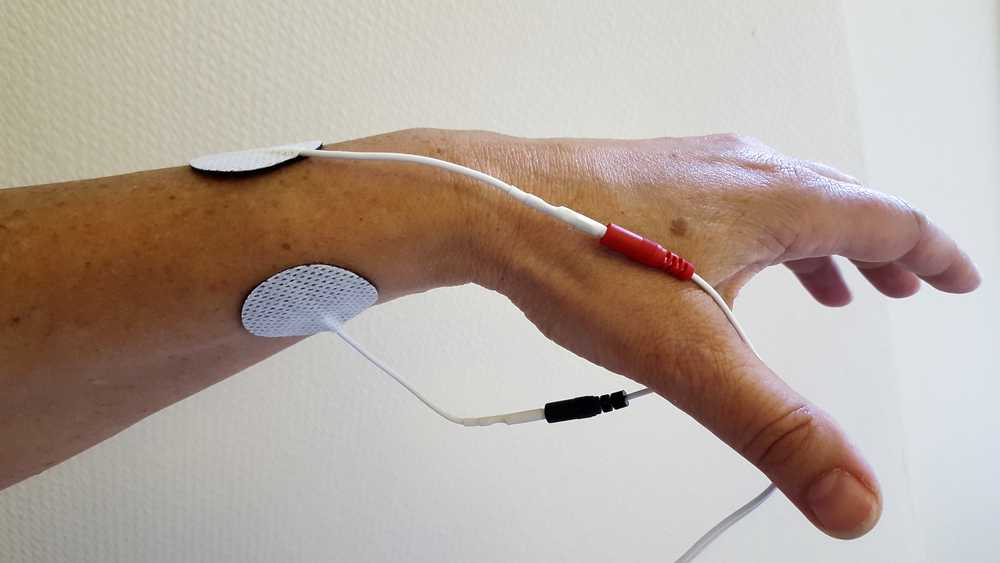 Физиолечение кисти Физиолечение кисти