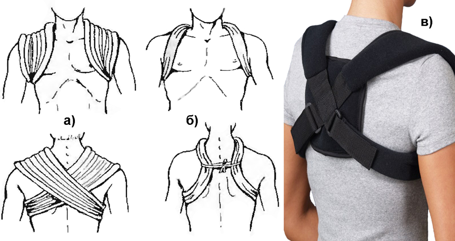 Формы колец Дельбе Формы колец Дельбе