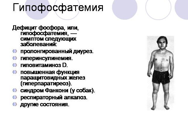 Гипофосфатемия Гипофосфатемия