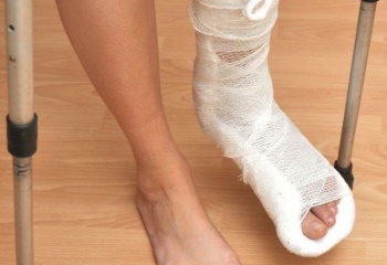 Гипсование перелома