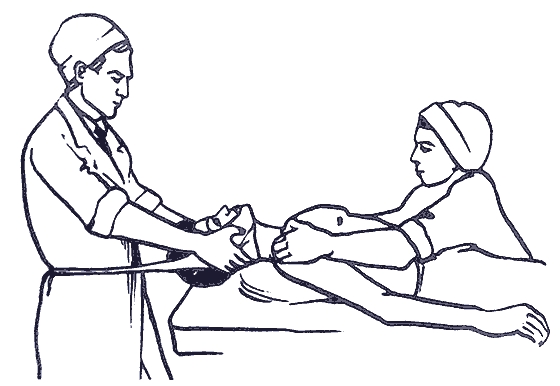 Горизонтальное вытяжение Горизонтальное вытяжение