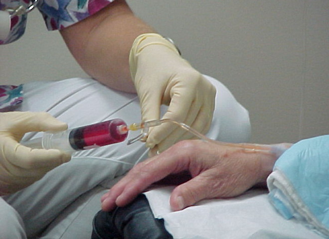 Химиотерапия Химиотерапия