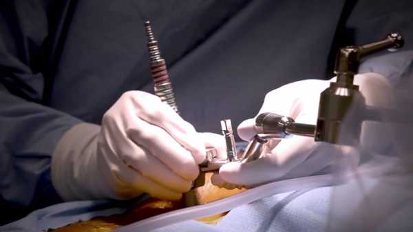 Хирургическая репозиция Хирургическая репозиция