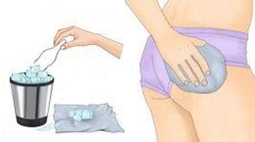 Холодный компресс к тазу