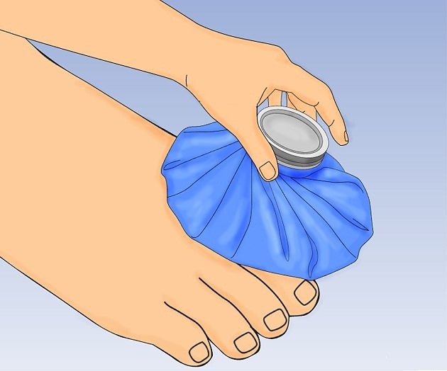 Холодный компресс на ноготь Холодный компресс на ноготь