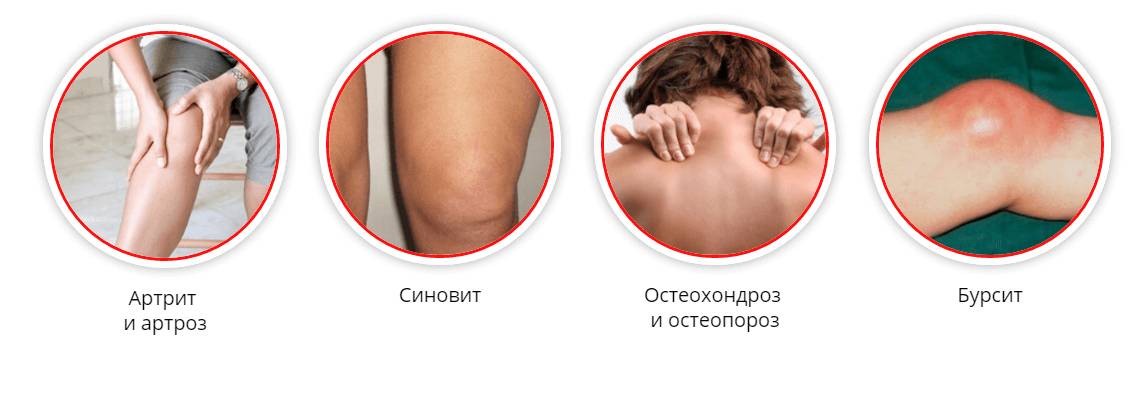 Показания для применения препарата Хондролок Показания для применения препарата Хондролок