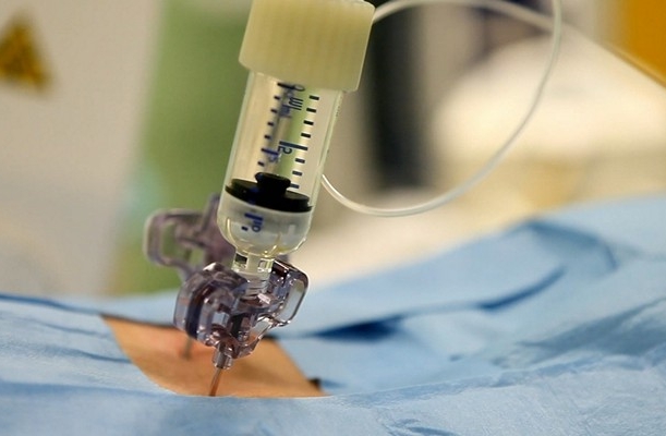 Инвазивная методика