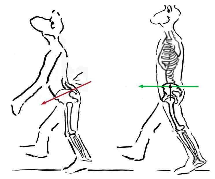Изменение походки при выраженном лордозе Изменение походки при выраженном лордозе