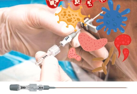 Занесение инфекции