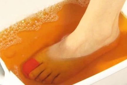 Йодовые ванночки от шпор Йодовые ванночки от шпор