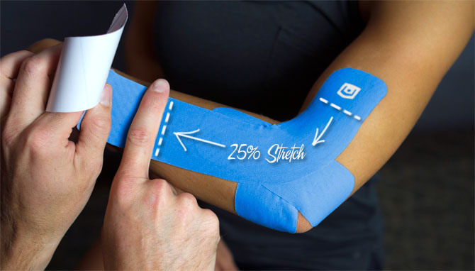 Кинезиотейпирование локтевого сустава Кинезиотейпирование локтевого сустава