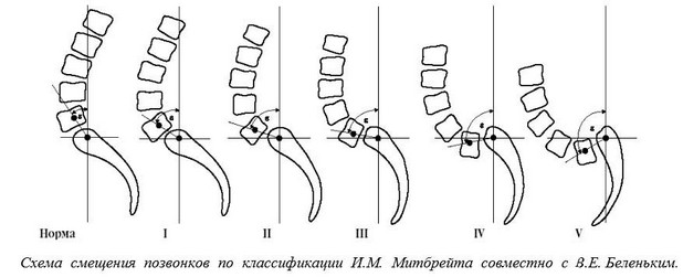 Классификация Мейердинга