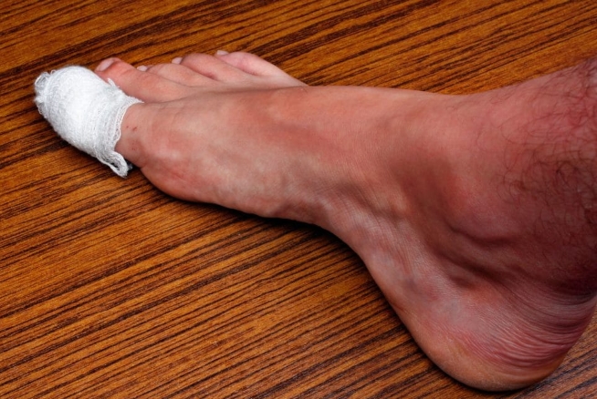 Компресс с чистотелом Компресс с чистотелом