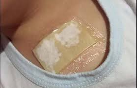 Компресс с жиром Компресс с жиром