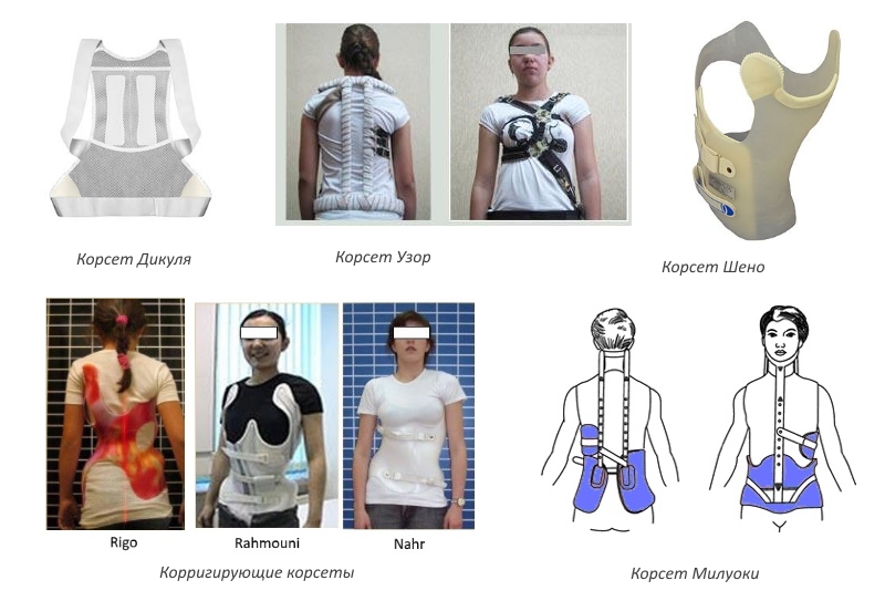 Типы корсетов Типы корсетов