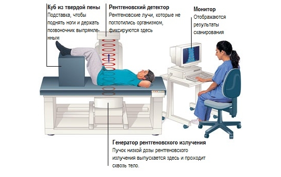Костная денситометрия позвоночника Костная денситометрия позвоночника
