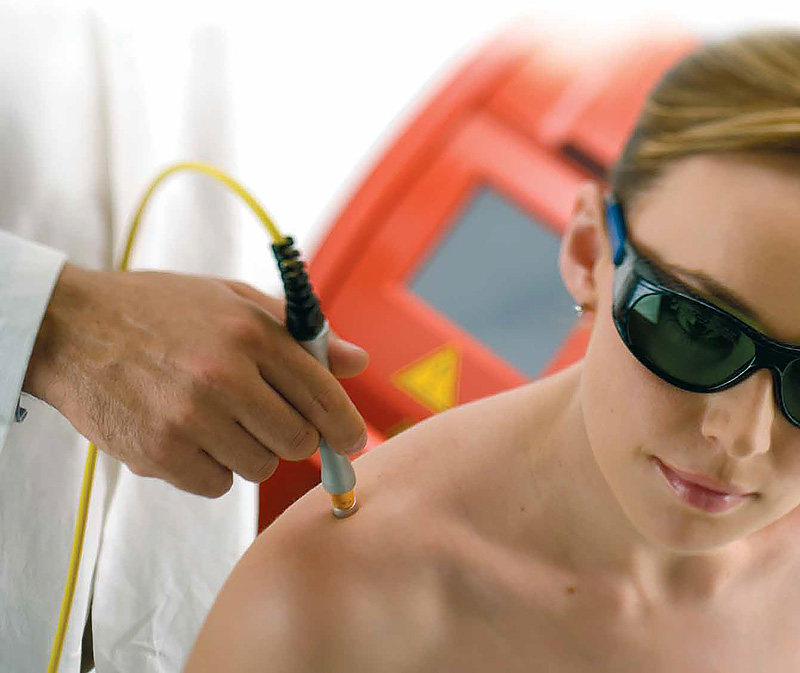 Лазерная терапия Лазерная терапия