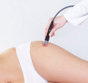 Лазеротерапия тазобедренного сустава Лазеротерапия тазобедренного сустава