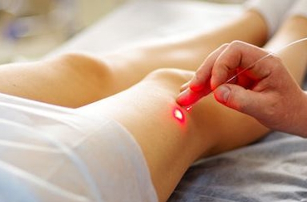 Лазерная терапия при артрите Лазерная терапия при артрите