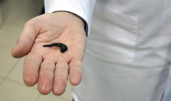 Лечебные пиявки Лечебные пиявки