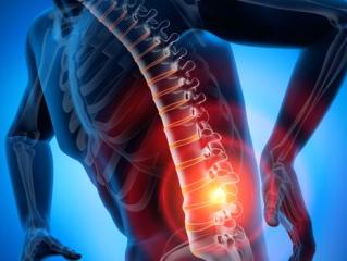 Лечение остеохондроза Бадягой-Форте