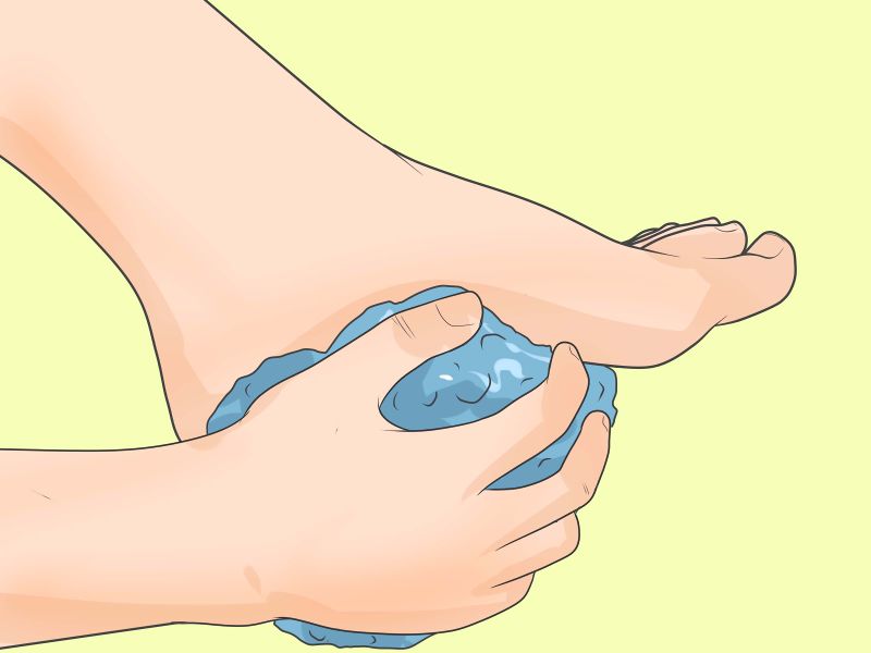 Прикладывание льда к пятке Прикладывание льда к пятке