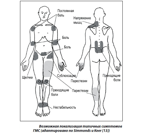 Симптомы синдрома гипермобильности Симптомы синдрома гипермобильности