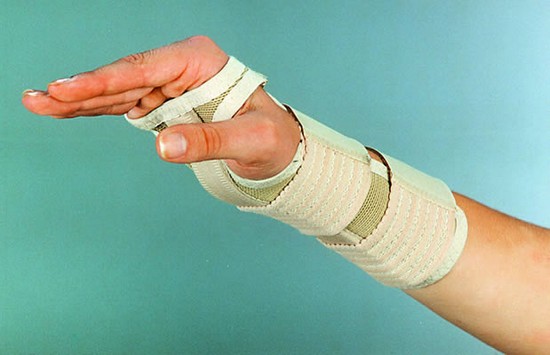 Лонгета при тендовагините Лонгета при тендовагините