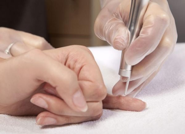 Лазерное удаление шишки на руке Лазерное удаление шишки на руке