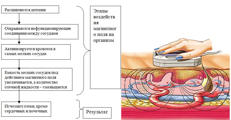 Функции магнитотерапии Функции магнитотерапии