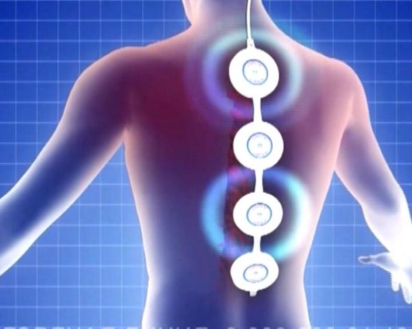 Магнитотерапия мышц спины Магнитотерапия мышц спины