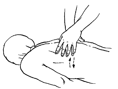 Массаж при межреберной невралгии Массаж при межреберной невралгии