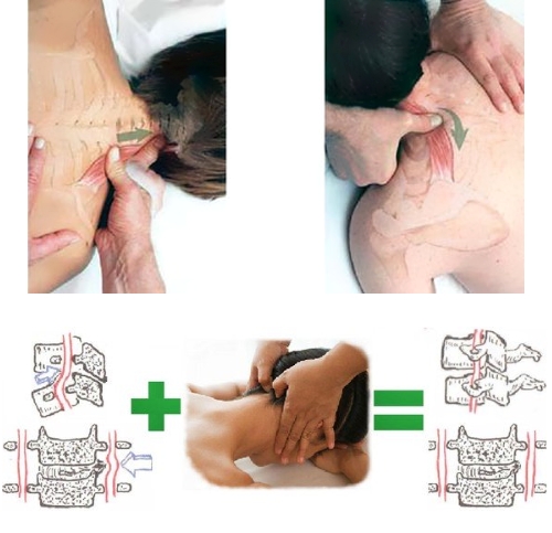 Массаж при остеохондрозе шейного отдела Массаж при остеохондрозе шейного отдела