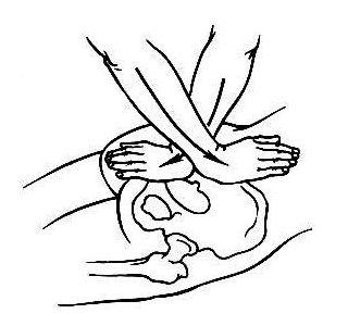 Массаж при сакроилеите Массаж при сакроилеите