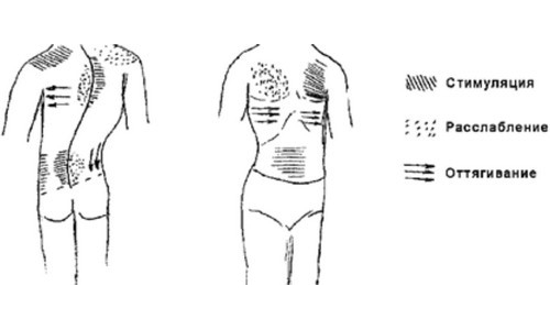 Массажные движения при сколиозе Массажные движения при сколиозе