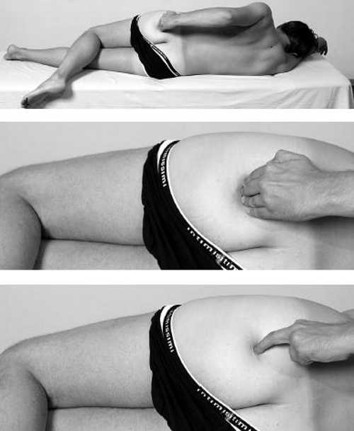 Массаж при спазме грушевидной мышцы Массаж при спазме грушевидной мышцы