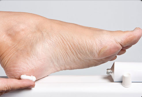 Лечение пяточной шпоры Лечение пяточной шпоры