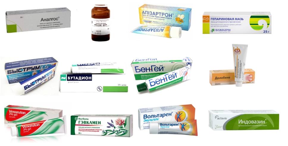 Мази при растяжении Мази при растяжении