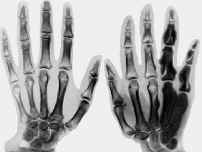 Рентген диагностика Рентген диагностика