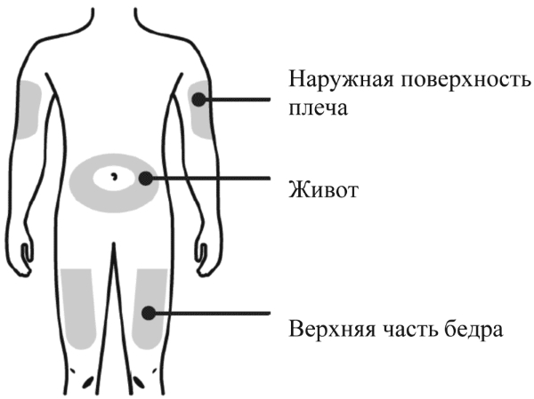 Места для введения инъекций Места для введения инъекций