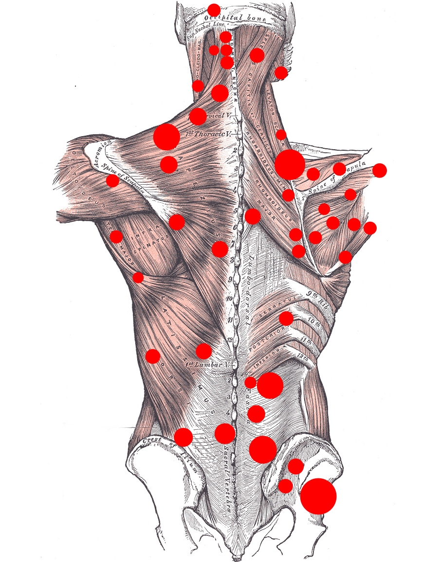 МФБС спины МФБС спины