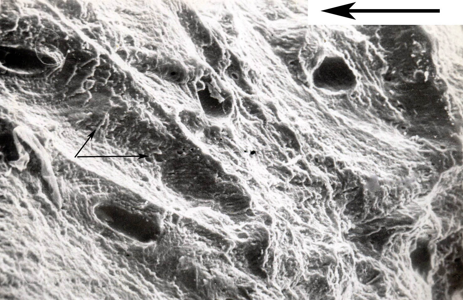 Микротрещины костей Микротрещины костей