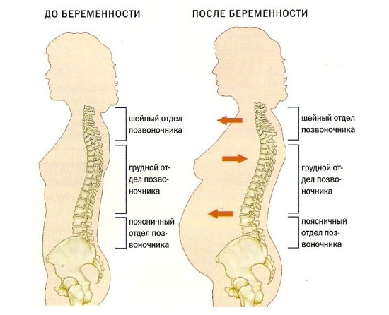 Нагрузка на позвоночник при беременности Нагрузка на позвоночник при беременности