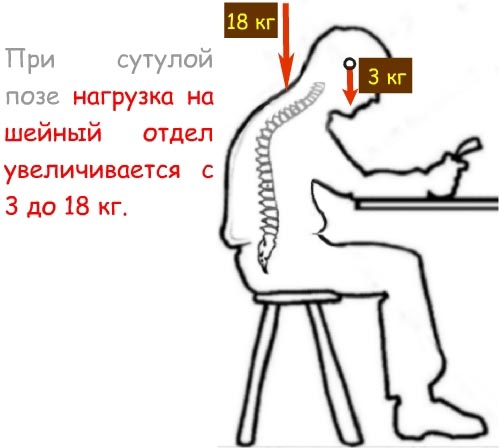 Нагрузка на шею при неправильной осанке Нагрузка на шею при неправильной осанке