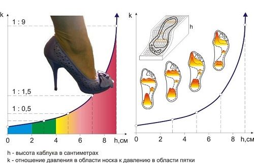 Нагрузка на стопу при неудобной обуви Нагрузка на стопу при неудобной обуви