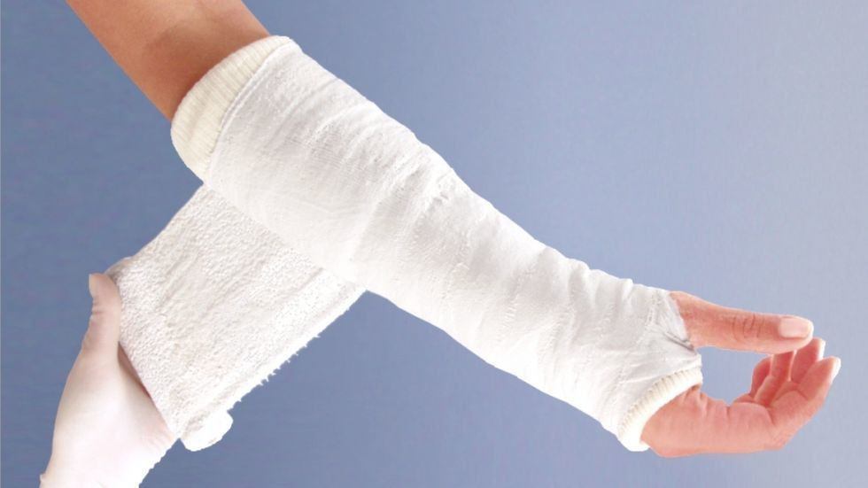 Наложение гипсовой повязки