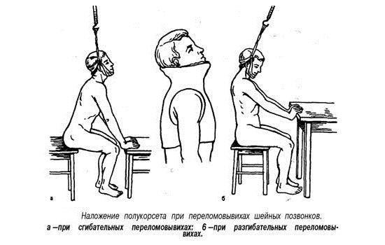Наложение полукорсета Наложение полукорсета