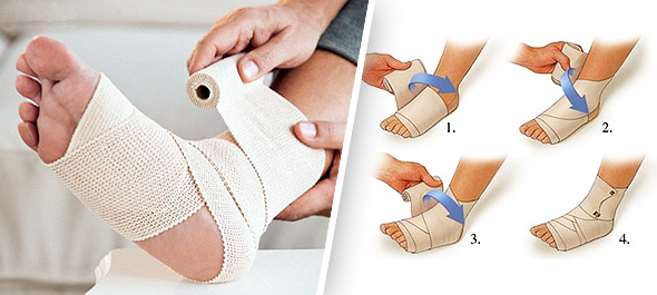 Наложение повязки при растяжении Наложение повязки при растяжении