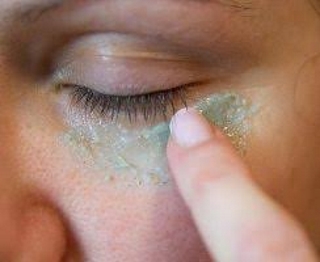 Нанесение геля на проблемную область